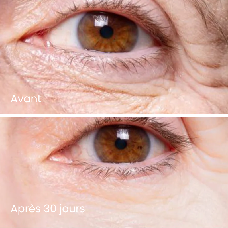 Patchs Micro-Infusion